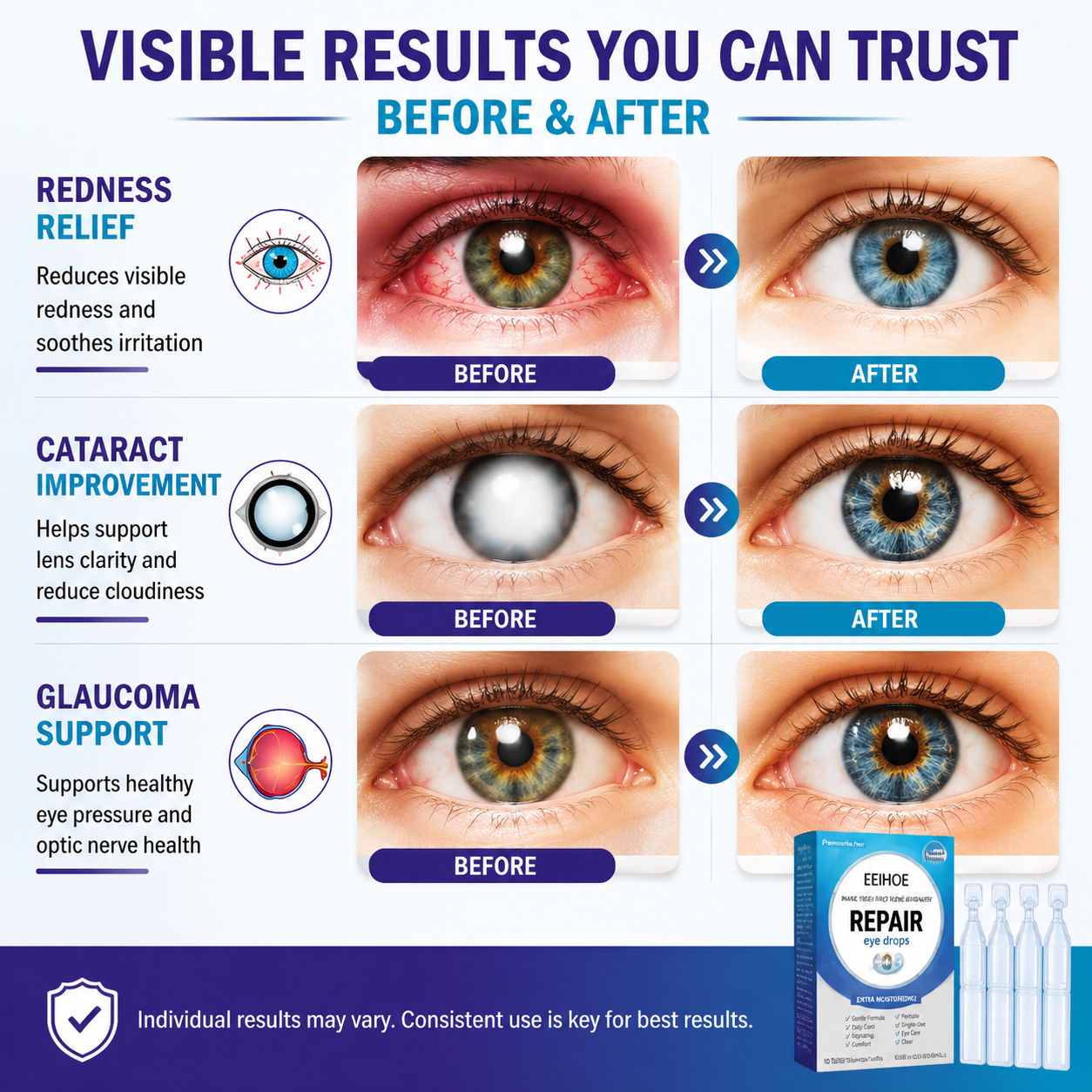 Single Use Repair Eye Drops – Soothe Red Eyes, Fix Blurry Cloudy Vision, Gentle Support for Cataract & Glaucoma-WH